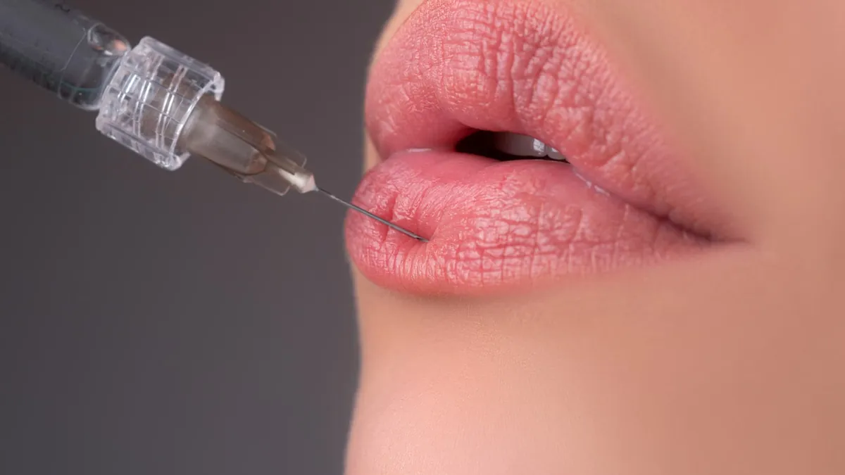Tratament cu acid hialuronic pentru buze